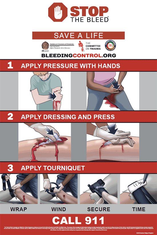Stop the Bleed instructions
